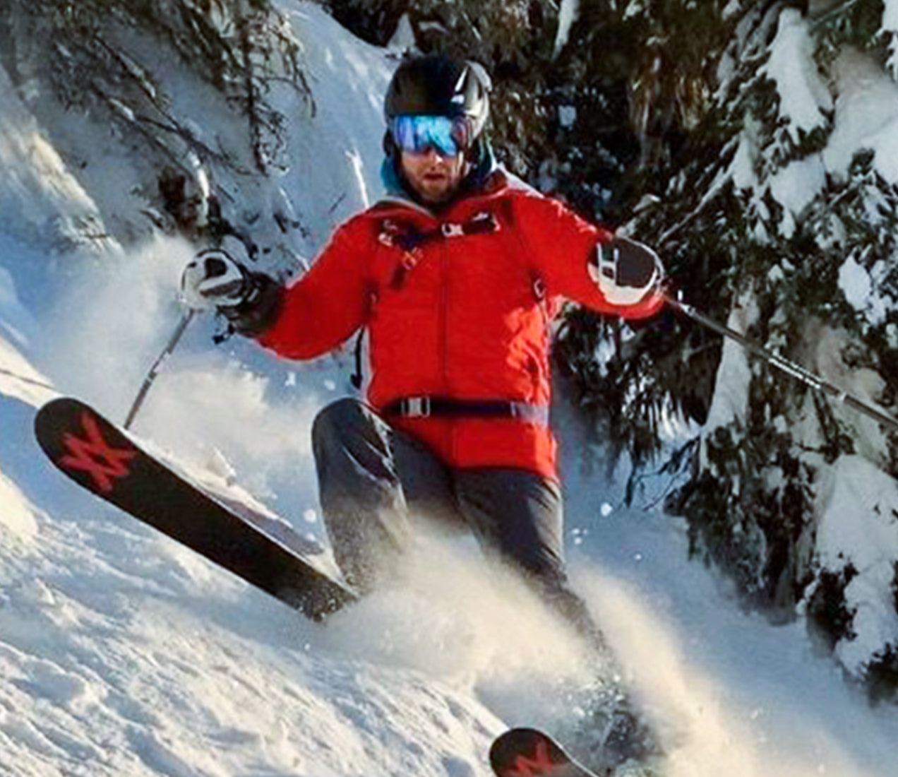 Momentous Stories: How Noah Jacobson Recovered from Spinal Fusion